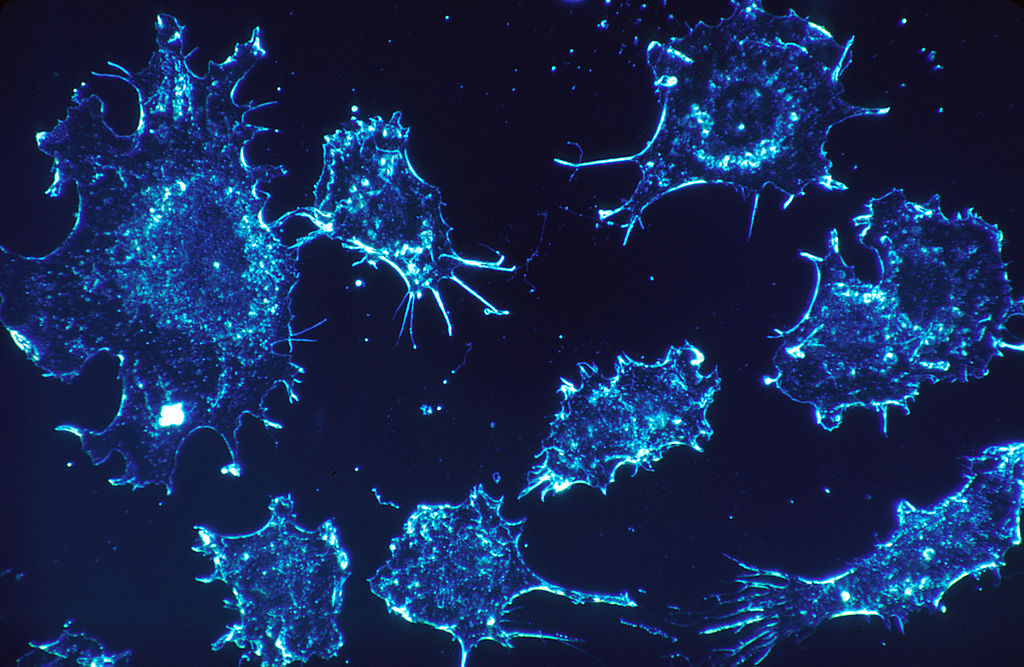 New Research Method Proves to Kill Cancer Cells in Two Hours